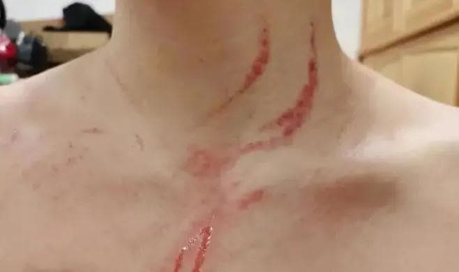 国际女足赛场上发生激烈的对抗，现场气氛紧张